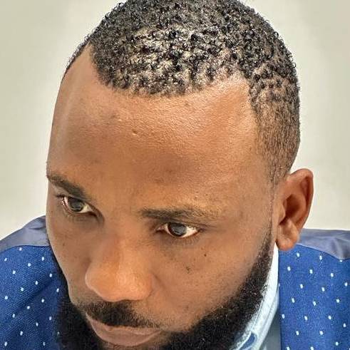 Denis NIYOKWIZERA
